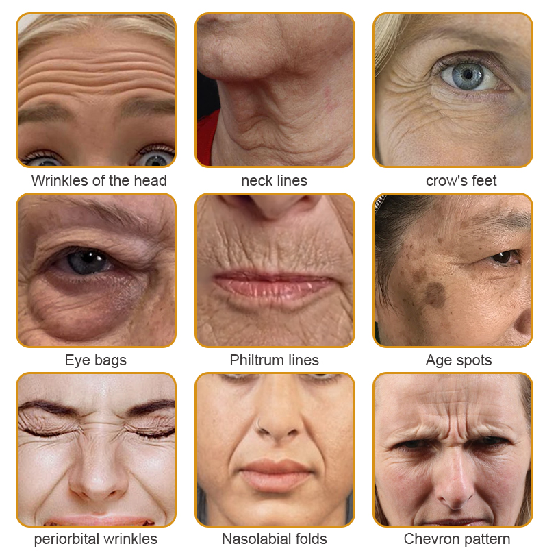 BeeBotox - Anti-Ageing Cream with Bee Venom and Botox