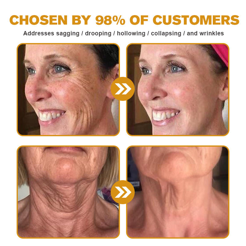 BeeBotox - Anti-Ageing Cream with Bee Venom and Botox