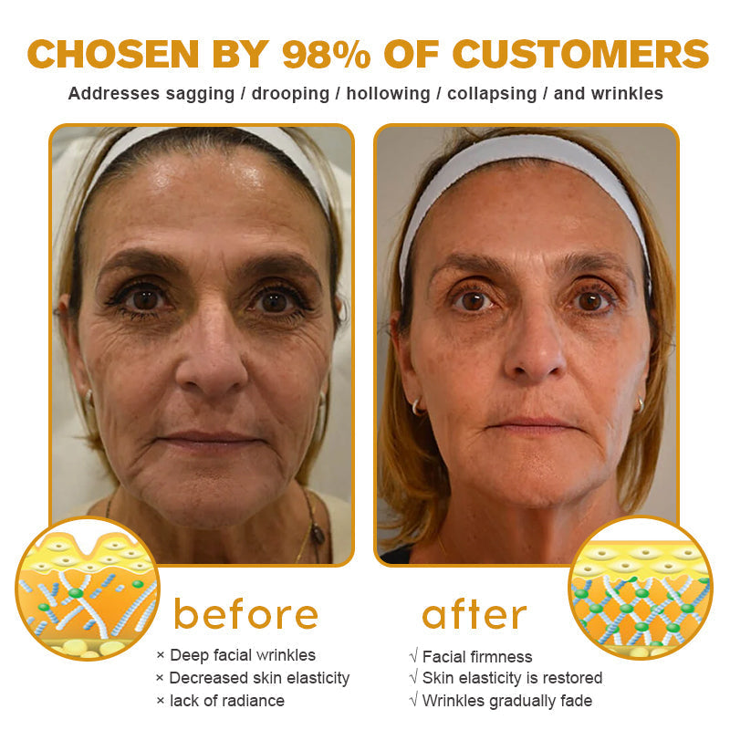BeeBotox - Anti-Ageing Cream with Bee Venom and Botox