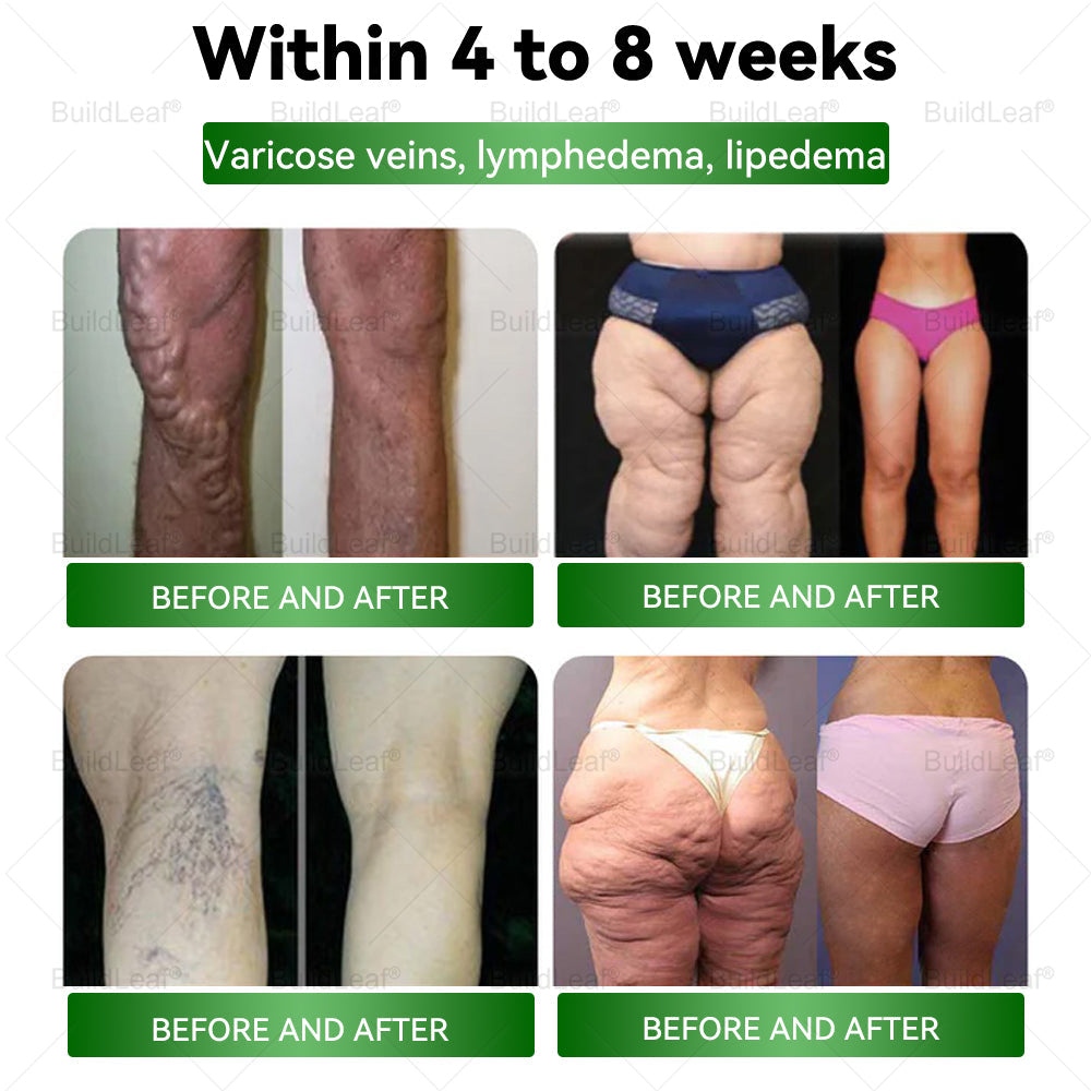 NatureTrim - Tirzepatide GLP-1 Moringa Slimming & Health Boost Drops