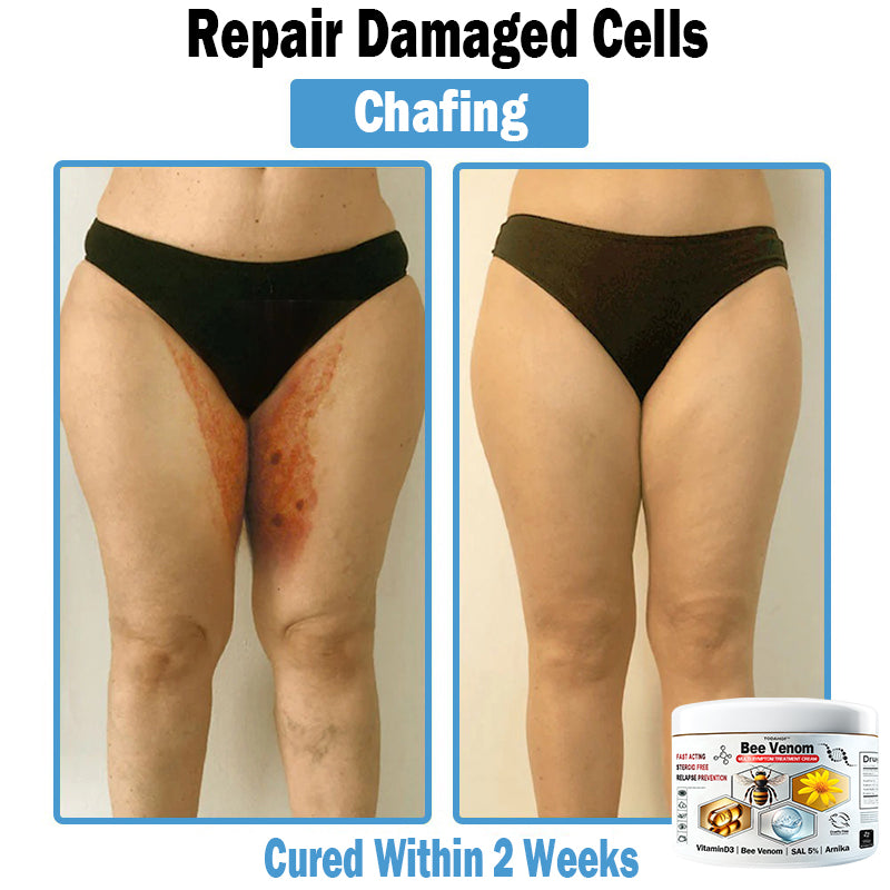 Bee Venom - Multi-Symptom Skin Treatment Cream